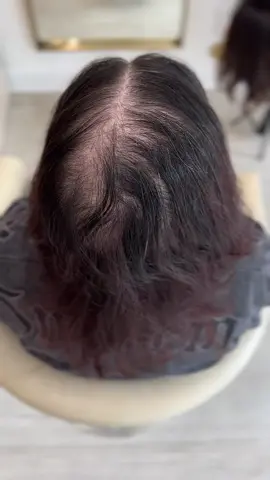 Hair toppers for hair loss. Perfect light weight solution! ❤️