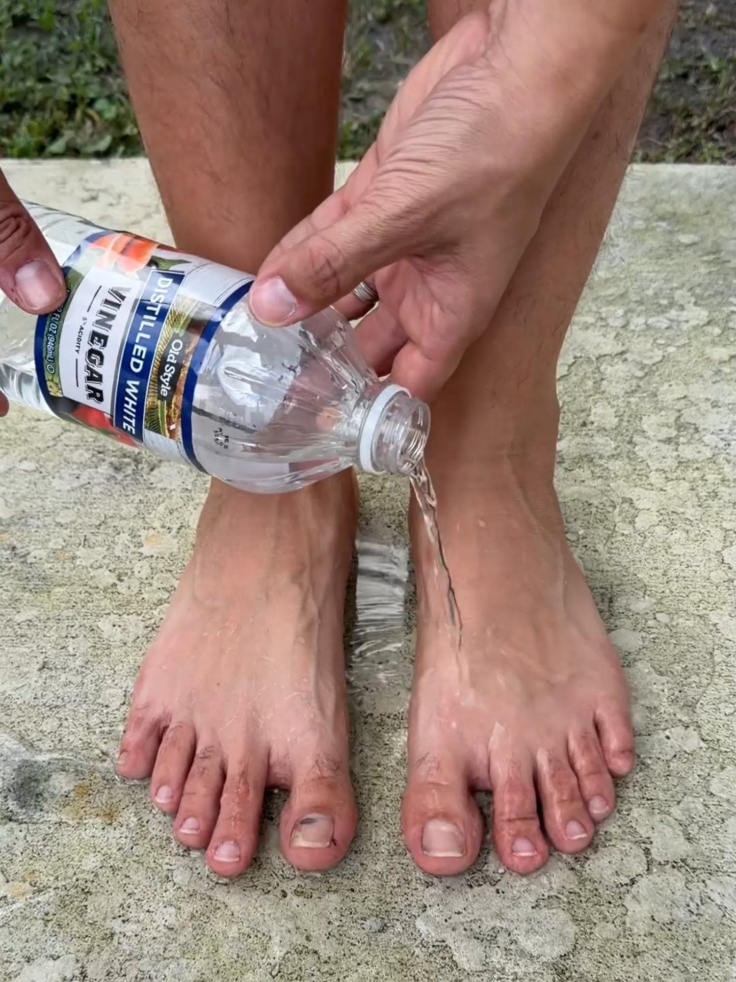Put vinegar on your feet and you'll be amazed by the results! #feet #footcare #lifehacks