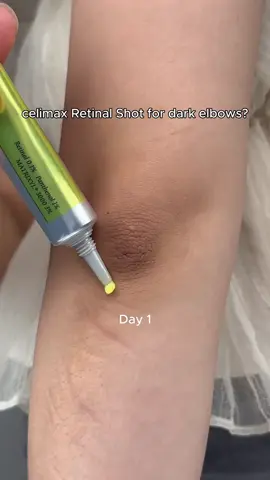 #اورفا_ساحه_المدفع🇹🇷🤘 