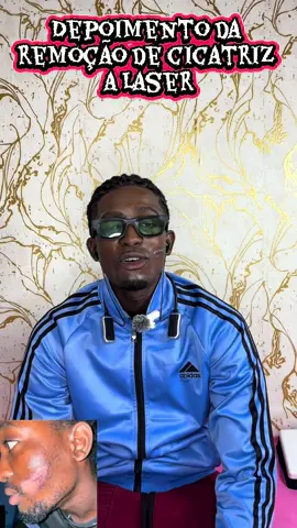 #Remocao de cicatrizalaser