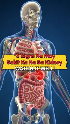 5 Silent Signs Your Kidneys Are in Trouble