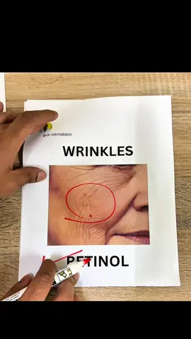 Most popular skin issues and treatments  #skincare #skincareroutine #Pigmentation #acne #usaskincareproducts 