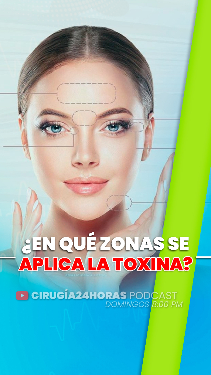 BOTOX: LAS ZONAS CLAVE DONDE SE APLICA 💉✨ #Botox #ToxinaBotulinica #EsteticaFacial #RostroFresco #TratamientosFaciales #CuidadoFacial #GlowUp #ClinicaEstetica