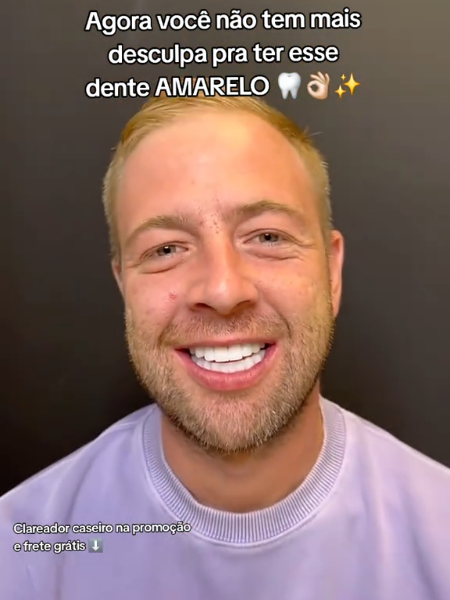 #dental #dentesbrancos #clareamentodental #tiktokshop #fyp 