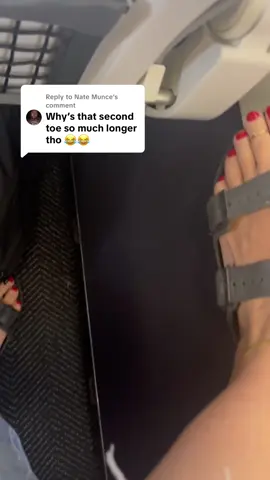 Replying to @Nate Munce It’s called a Greek toe (or Morton’s toe)! It’s actually quite rare and considered very pretty in classical art and beauty standards 🤌