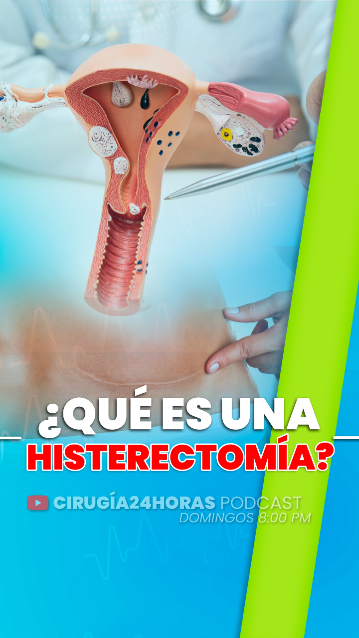 ¿QUÉ PASA SI TE QUITAN EL ÚTERO? LA HISTERECTOMÍA EXPLICADA 🩺🤰 #Histeroctomía #Saludfemenina #Ginecología #Miomas #Endometriosis #CirugiaDeUtero #EducacionMedica #LoQueDebesSaber