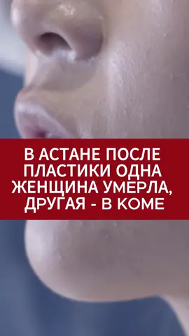 #астана #женщина #пластика 