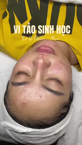 Công nghệ thì khá nhiều nhưng chưa ai nói với bạn làm sao để đạt được hiệu quả tối ưu nhất #vitao #vikimsinhhoc #gangwonskinlab #trendingvideo 