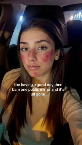 #skincare #acne #skincareroutine #GlowUp 