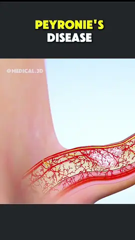 #healthytips #foods #fyp #usa🇺🇸 #everyday 