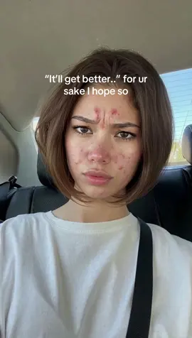 #skincare #glassskin #acne #GlowUp #skincareroutine 