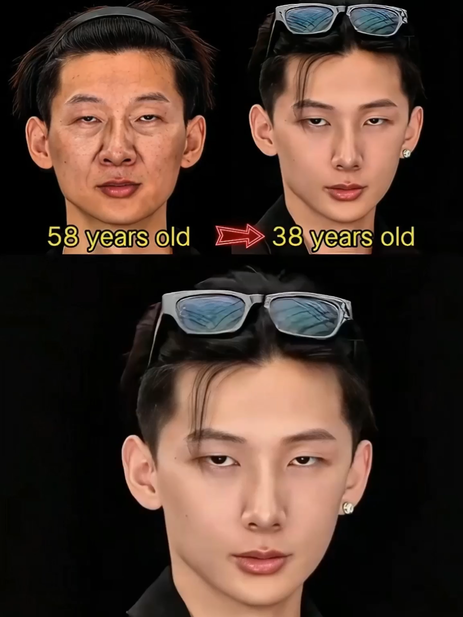 Masih bingung cara menghilangkan kantung mata yang bikin wajah keliatan tua dan capek? Coba krim mata retinol dengan formula 5x lebih terkonsentrasi! Bukan cuma memudarkan kantung mata, tapi juga mengurangi garis halus & lingkaran hitam. Direkomendasikan dokter kulit, hasil nyata dalam pemakaian rutin! ✨#eyebags #foryou #skincare #darkcircles #eyecream