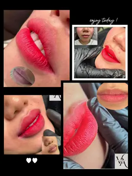 Môi thâm giờ ko còn là nỗi lo của các ce nữa 🥰  #vyanhbeauty #tiệmdachữalành #khuthammoi #phunmoi #pmu #phunxamthammy #xuhuong #viral #CapCut 