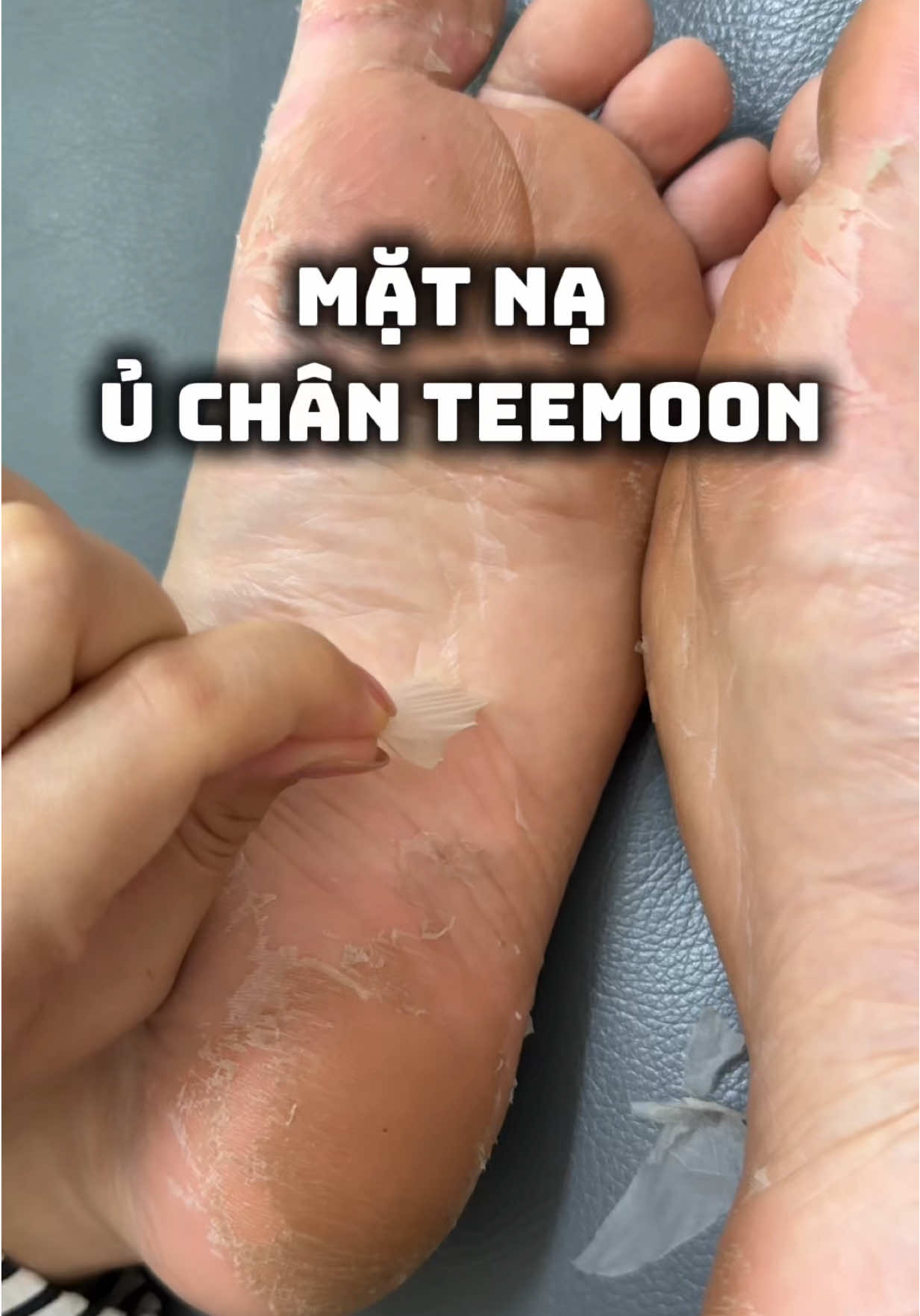Bóc ra cả mảng rồi da chân mịn sáng hẳn #linhdungroi #matnauchan #uchan #teemoon 