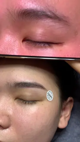 Ưng nè #chamsocdamun#chamsocdaseo#chamsocdanam#tanbinh#Lqspa 