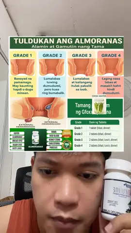 #livehighlights #tiktoklive #almoranas #hemoroids #gfoxxspirulina 