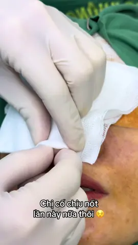 #nangmui #xuhuong #bsphamhao #suamuihong #gheptrungbi 