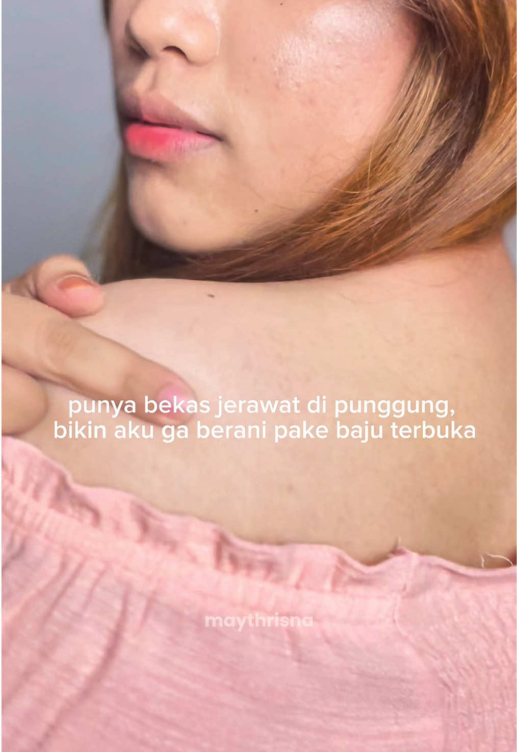 ga sia sia rutin pake lotion satu ini karena emg beneran works🥹 @By Jevarine  #Jevarineacnebodylotion #KulitSensitif #LotionHalus 