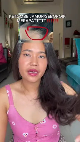 aaakk sampo termurce buat ketombe parahku!!🥺 @Kelaya Hair Treatment #yourdailyexpert #kelayahairexpert 