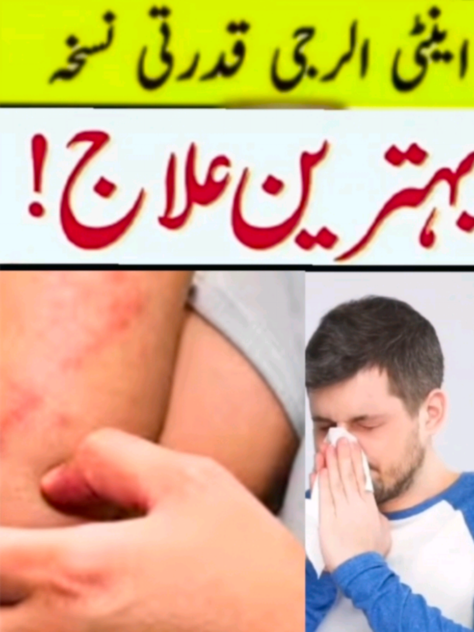 [22/10, 10:41 am] Meta AI: Anti-allergic options often involve medications or natural remedies that help alleviate symptoms of allergies. Here are some common anti-allergic solutions: Medications 1. *Antihistamines*: These medications can help relieve symptoms of allergies, such as itching, sneezing, and runny nose. 2. *Decongestants*: These medications can help reduce nasal congestion and sinus pressure. 3. *Corticosteroids*: These medications can help reduce inflammation and swelling in the nasal passages. Natural Remedies 1. *Haldi (Turmeric)*: Curcumin in haldi has anti-inflammatory properties that may help alleviate allergy symptoms. 2. *Honey*: Local honey may help desensitize individuals to pollen allergies. 3. *Quercetin*: This flavonoid found in fruits and vegetables may help stabilize mast cells and reduce histamine release. Lifestyle Changes 1. *Avoid triggers*: Identify and [22/10, 10:41 am] Meta AI: Anti-allergic options often involve medications or natural remedies that help alleviate symptoms of allergies. Here are some common anti-allergic solutions: Medications 1. *Antihistamines*: These medications can help relieve symptoms of allergies, such as itching, sneezing, and runny nose. 2. *Decongestants*: These medications can help reduce nasal congestion and sinus pressure. 3. *Corticosteroids*: These medications can help reduce inflammation and swelling in the nasal passages. Natural Remedies 1. *Haldi (Turmeric)*: Curcumin in haldi has anti-inflammatory properties that may help alleviate allergy symptoms. 2. *Honey*: Local honey may help desensitize individuals to pollen allergies. 3. *Quercetin*: This flavonoid found in fruits and vegetables may help stabilize mast cells and reduce histamine release. Lifestyle Changes 1. *Avoid triggers*: Identify and avoid allergens that trigger symptoms. 2. *Stay hydrated*: Drink plenty of water to thin out mucus and reduce congestion. 3. *Use HEPA filters*: Use air purifiers with HEPA filters to reduce allergen exposure. Consult with a healthcare professional before starting any new medications or remedies for allergies. #viral #foryoupage #health #dermatologist #trending 