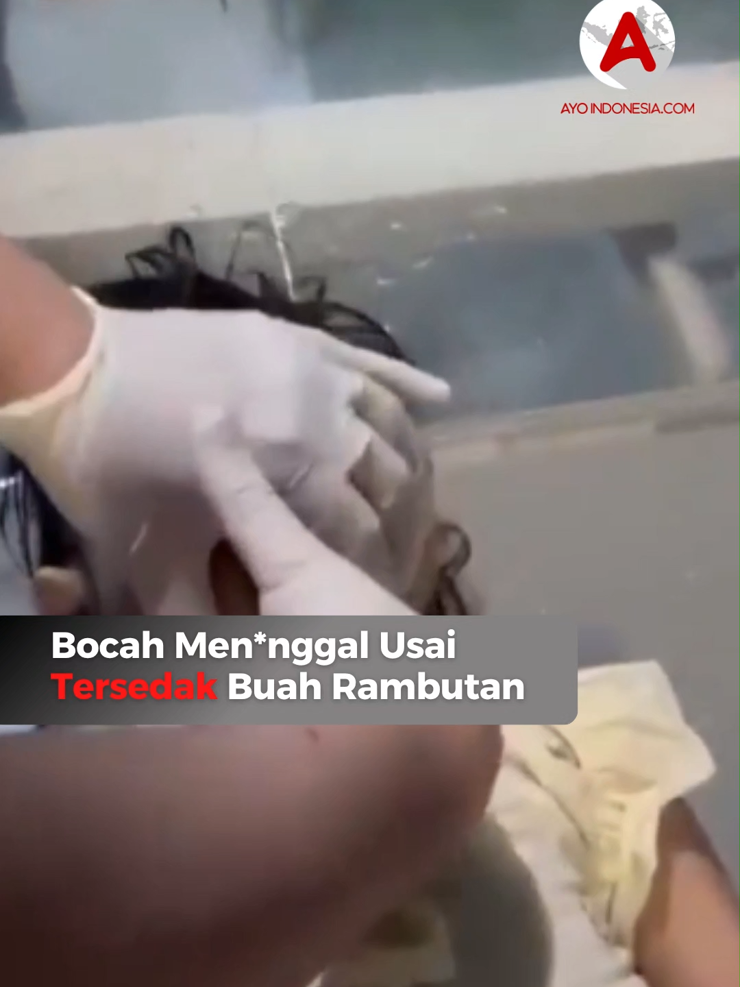 ⚠️TRIGGER WARNING, BISA MEMBUAT KETIDAKNYAMANAN ⚠️ Peristiwa tragis terjadi di Lahad Datu, wilayah timur laut Pulau Kalimantan, Malaysia. Sebuah video yang ramai beredar memperlihatkan momen menyayat hati saat seorang bocah perempuan kehilangan nyawanya setelah tersedak buah rambutan yang ia makan. Dari informasi yang beredar, kejadian bermula ketika sang anak tengah asyik menikmati buah rambutan. Namun tanpa disadari, potongan buah yang ditelannya justru tersangkut di tenggorokan. Keluarga yang panik langsung membawa korban ke fasilitas kesehatan terdekat. Meski tenaga medis telah berusaha melakukan pertolongan, nyawanya tak dapat diselamatkan. Tragedi ini menjadi peringatan bahwa tersedak bukanlah hal sepele. Kondisi darurat ini dapat merenggut nyawa dalam waktu singkat bila tak segera ditangani. Saat saluran napas tersumbat, suplai oksigen ke otak dan paru-paru terhenti, menyebabkan kerusakan fatal hanya dalam hitungan menit. Follow terus @ayoindonesiacom #viral #buahtrambutan #lahaddatu #kalimantan