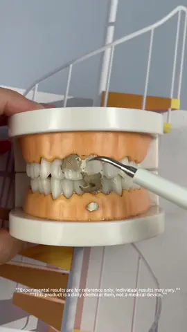 How long has it been since you last cleaned your teeth?#dentalcleaning #teethtok #teethcleaning #cleanteeth #teethwhitening #tiktokmademebuyit #tiktokshopgift #Halloween #blackfriday 