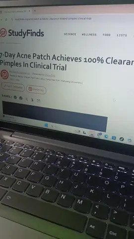 acne patch #acnepatch #acnefighter #acneproneskin #viral #edukasi 