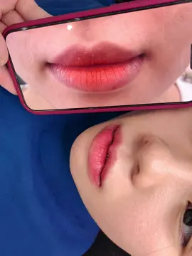 Cắt tạo hình môi, kết hợp thu gọn môi dưới. Cắt môi đẹp tại Bắc Ninh nhắn e liền ạ 🥰 #xuhuong2024 #bacninh #catmoi #cắtmoidep #sửamoiloi 