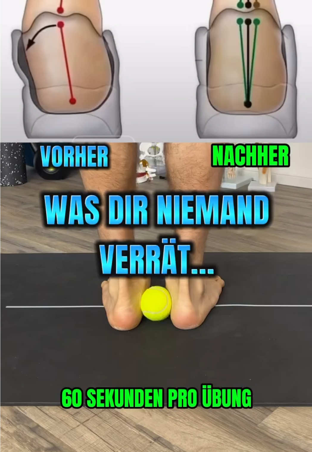 Ich investiere täglich 5-10 Minuten in meine Füße! Wie siehst es bei dir aus? #dkhealth #gesundheit #fit #plattfuß #hallux 