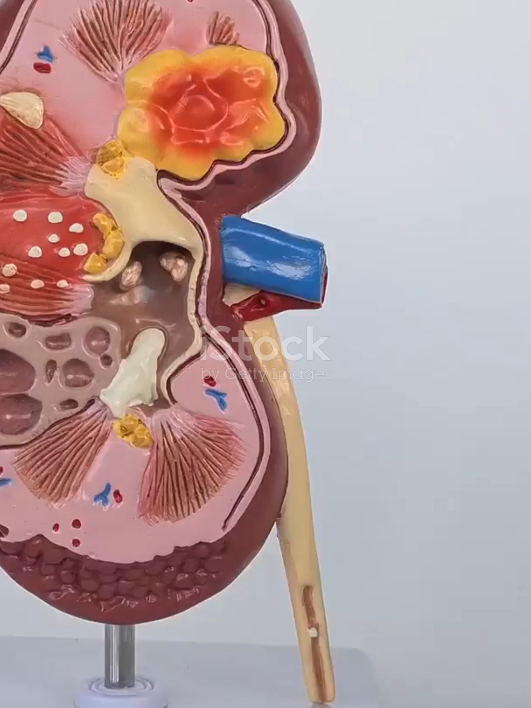 The smallest damage can cause the biggest impact. #KidneyHealth#BodyAwareness #WellnessTips #KidneyCare #HealthEducation #HealthyLifestyle