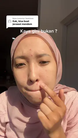 Membalas @Yeahhhmn Langsung aja deh liat progressnya di video ini 👉🏻 Gimanaa? Gaperlu ragu, langsung aja checkout sekarang 🔥 #jerawatmendem #acneproneskin #facemist #bruntusan #pratistaskincare 