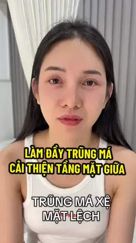 Mặt lệch , trũng má xệ thì chị em cứ làm đầy trũng má nha #nganle #xuhuong #ilovetiktok #trũngmá #tầngmặtgiữa 