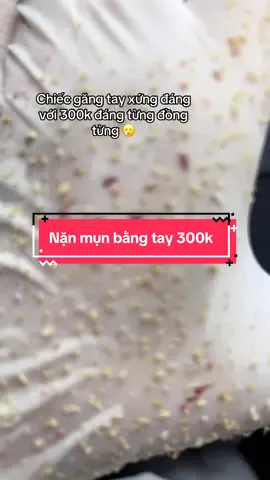 300 mà dùng sản phẩm xịn xò , nặn mụn bằng tay nhẹ nhàng mà còn không giới hạn thời gian #nặnmunbangtay #lấynhanmunbangtay #Chămdachuẩnykhoa #điều_trị_mụn #Dieutrimun 
