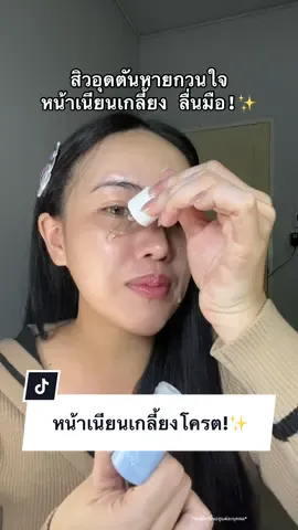 หน้าเนียนเกลี้ยงโครต💖 #เซรั่มละลายสิวอุดตันblahmbooh #เซรั่มละลายสิวblahmbooh #เซรั่มละลายสิว #สิวอุดตัน #blahmboohthailand 