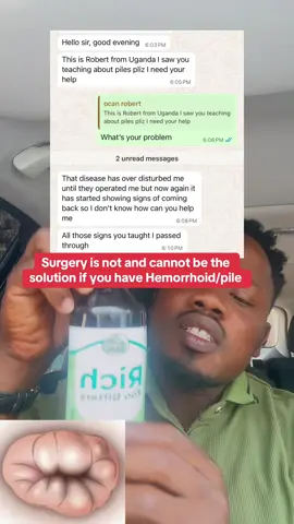 Pile treatment #richeweherbaltips #ewecommunityherbstips #fyp 