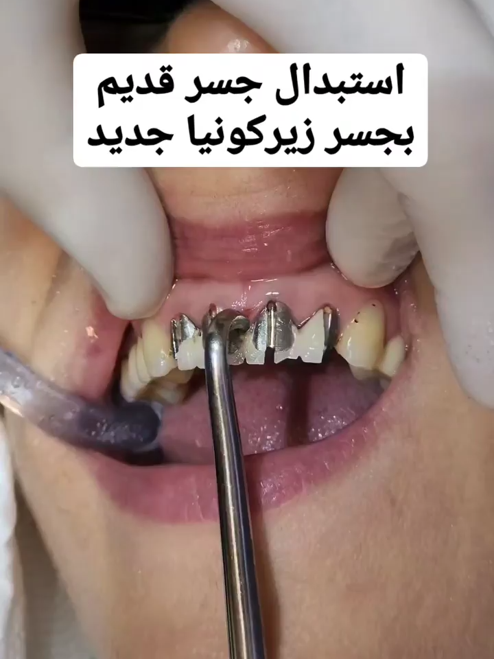 #الرباط #morocco #مكناس #تمارة #meknes #agadir #temara #فاس #marrakech #مراكش #المغرب #nador #طنجة_عروسة_الشمال #fes #rabat #المغرب🇲🇦تونس🇹🇳الجزائر🇩🇿 #اكادير #casablanca #zagora #tiznit #tarodant #زاكورة #كازابلانكا #الدار_البيضاء #هوليوود_سمايل #عدسات #belgium #germany #france🇫🇷 #españa #madrid #italy🇮🇹 #barcelona #malaga #valencia #torino #دبي #tunisia #tunisia🇹🇳 #paris