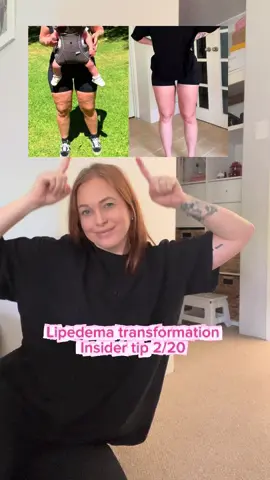 Vibration therapy can be a game changer for those living with lipedema.   The gentle vibrations help stimulate lymphatic flow, reduce fluid buildup, and increase circulation — all of which can help relieve heaviness, pain, and swelling. It also supports tissue elasticity and can make manual lymphatic drainage or compression therapy even more effective when used regularly. 🙌 If you’re looking for simple ways to support your lymphatic health and manage lipedema naturally, you’ll love what’s inside my Ultimate Lipedema Guide — packed with tools, workouts, and lifestyle tips designed just for you. Link to my guide in bio, inbox “vibration” for the link to the plate  #lipedema #transformation #vibration #lymphaticdrainage #dailyhabits 