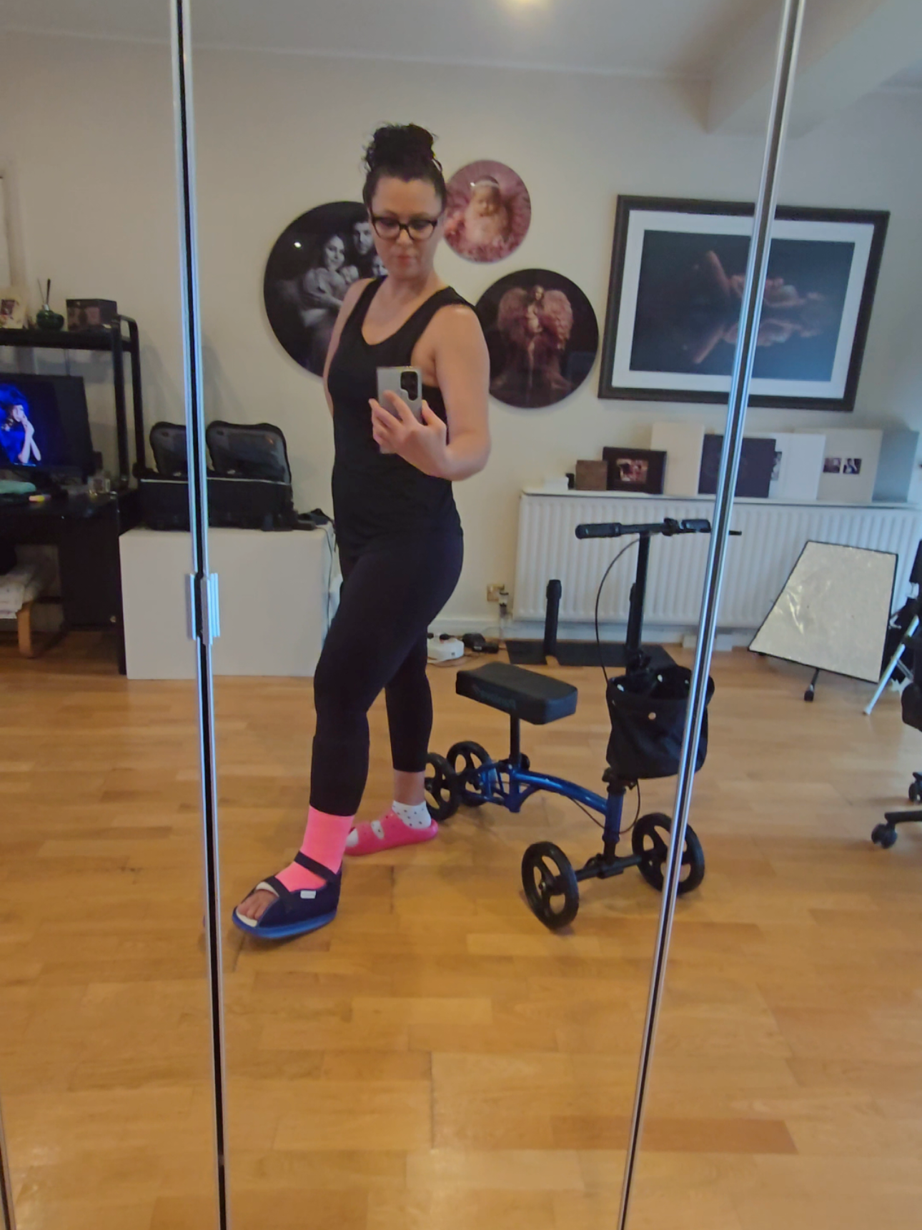 this is going to take time  #anklesurgery #brokenankle #cast #anklefracture 