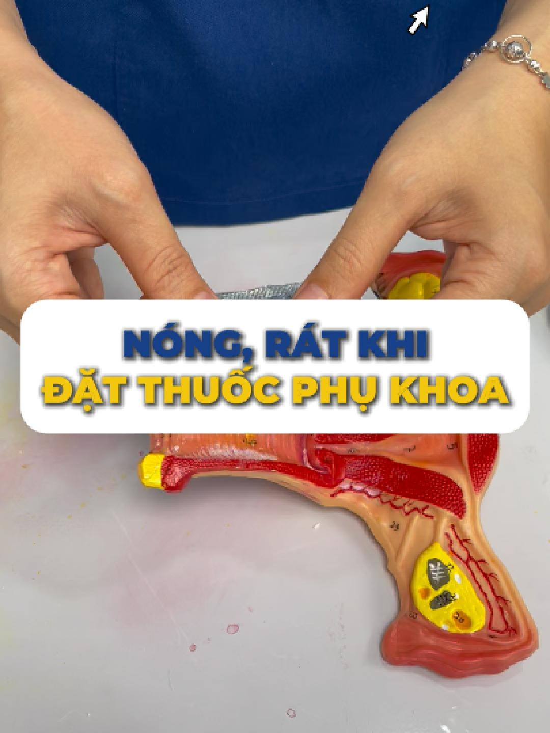 Nóng, rát khi đặt thuốc? Phải đặt đúng cách và có thể bị dị ứng với thành phần thuốc nhe. #bstranhanhnhan #myphap #sankhoa #thuocdatphukhoa #LearnOnTikTok #trending #fyp #tiktok