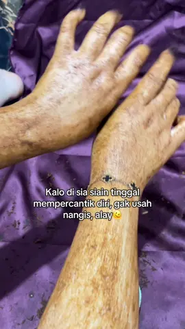 Gak udh nngis deh, mending bahagiain dirimu, dengan mempercantik diri😍❤️ #lulurhitam3s #lulurrempah3s #lulurpemutihbadan #beddalotong #lulurbadan 