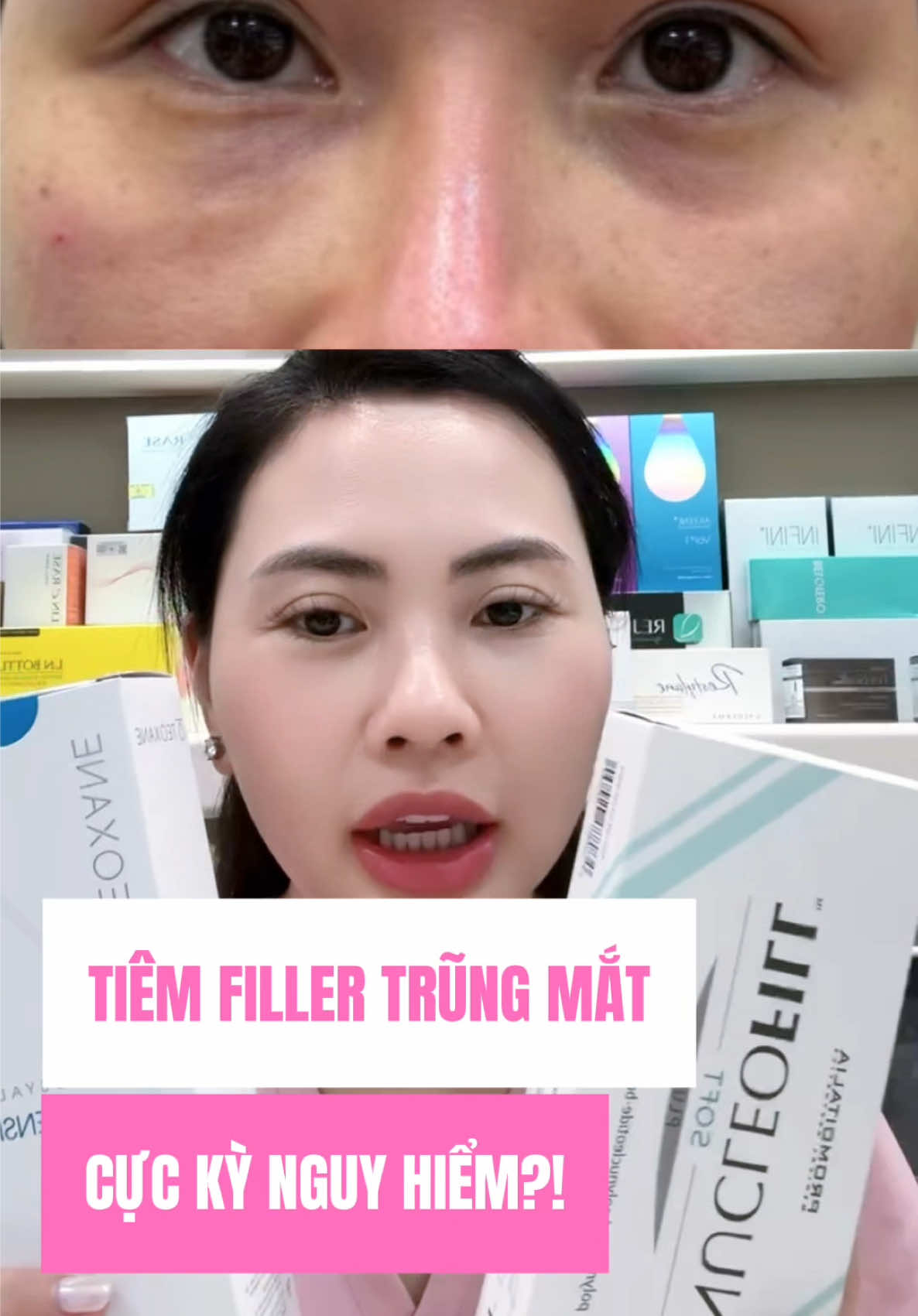 Filler hay tăng sinh trũng mắt an toàn hơn #TikTokAwardsVN #LearnOnTikTok #mesotherapy #lamdepkhongkho #trending 