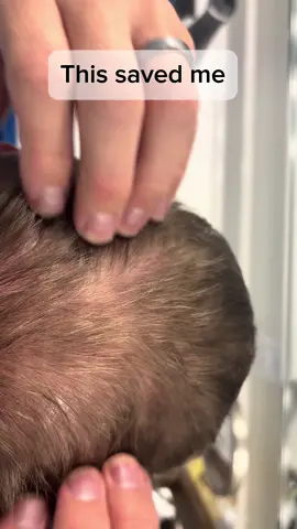 Can’t believe this actually works 😅 Been using the @hims Thick Fix Shampoo and my hair legit feels fuller 🔥 #hims #haircareformen #thinninghair #thickhairgoals #tiktokshopcreatorpicks 