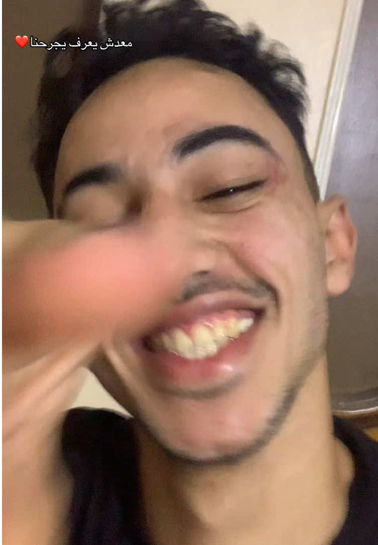 اموت في الحب البجح❤️ #نسر_البلد #WelcomeWassouf #جرحونا 