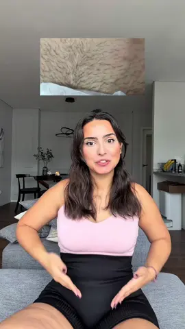 Mi cuca solo estaba irritada 😣 #peachslices #sinpuntosnegros #TikTokShopCreatorPicks #TikTokShopBlackFriday #TikTokShopCyberMonday 