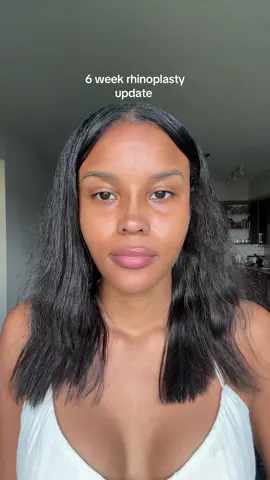 #nose #nosejob #relatable #rhinoplasty #relatabl 