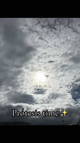 Parte1✨❤️#guatemala #foryou #foryoupage #discapacidad #protesis #emprendimiento #paratiiiiiiiiiiiiiiiiiiiiiiiiiiiiiii #paratii #viral #storytime #guatemala🇬🇹 