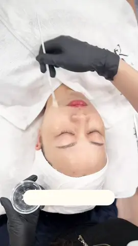 Chị Em Muốn Da Căng Bóng, Trẻ Hoá, Sáng Da Thì Không Thể Bỏ Qua Em Peel Icon Skin Mandelic Này Nhé #peel #cangbongda #iconskin #iconskin12 #mandelic #sangda #trehoada 