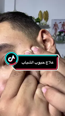 فاكيشن سيبيو كنترول لعلاج حبوب الشباب😳 #fyp #حبوب_الشباب #علاج_حب_شباب #acne #vacation 