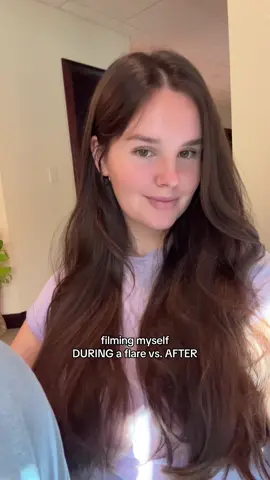 the inflammation is crazy😵‍💫 I despise flares #heds #pots #mcas #endo  #mecfs #spoonie 