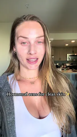 I’m on a journey of treating hormonal acne and here’s the products that have been helping! These towels have been a game changer to fight bacteria ✨ #mixiskincare #skincareroutine #hormonalacne #wellnessjourney #clearskin 